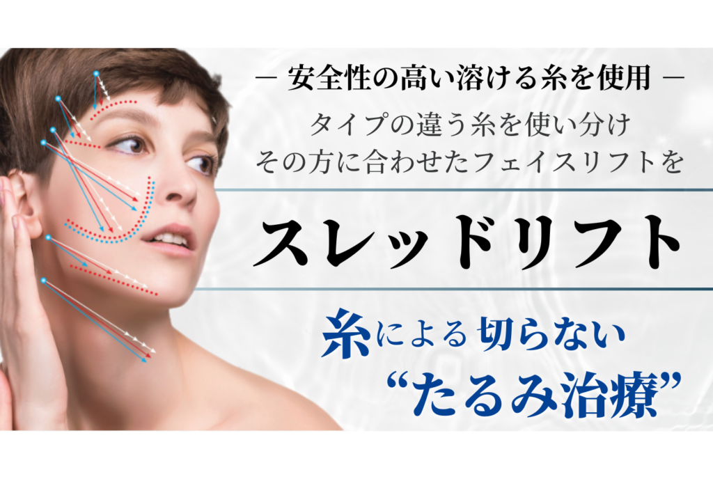 スレッドリフト（糸リフト）たるみ・リフトアップ